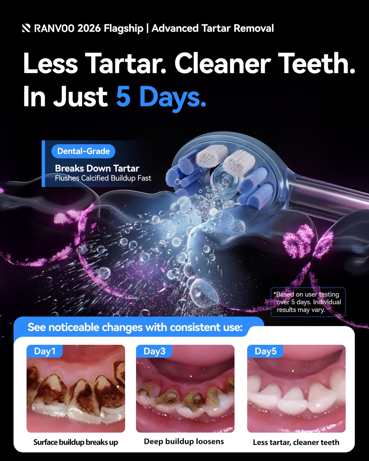 RANVOO AirJet X5 [Dentist Recommended | Max Tartar Removal] Electric Toothbrush, 100% Plaque Removal, Whitening & Gum Care, 60-Day Battery Life, Rechargeable with 3 Pro Brush Heads, Space Gray