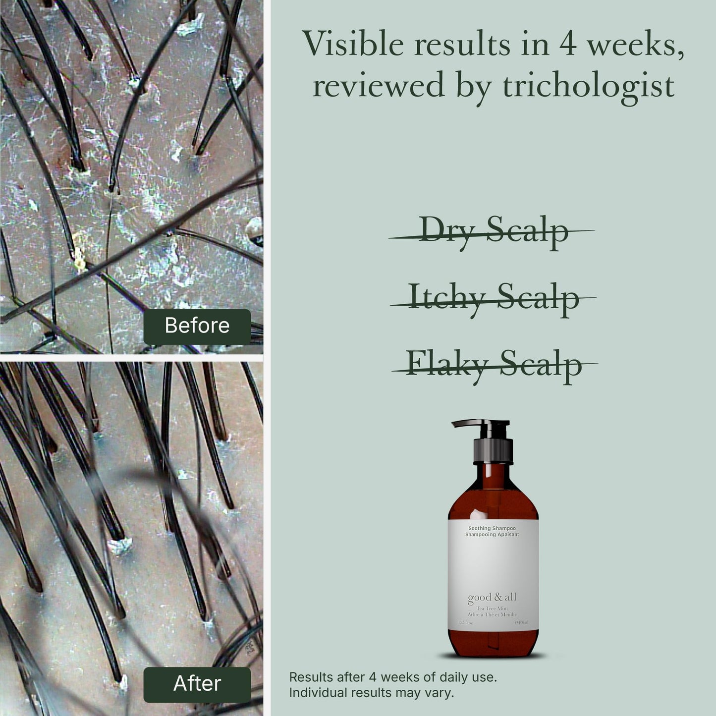 GOOD&ALL Tea Tree Shampoo for Dry Itchy Scalp with Peppermint - Sodium Lauryl Sulfate/Sulphate, Silicone, Paraben, Fragrance Free - 13.5 fl oz