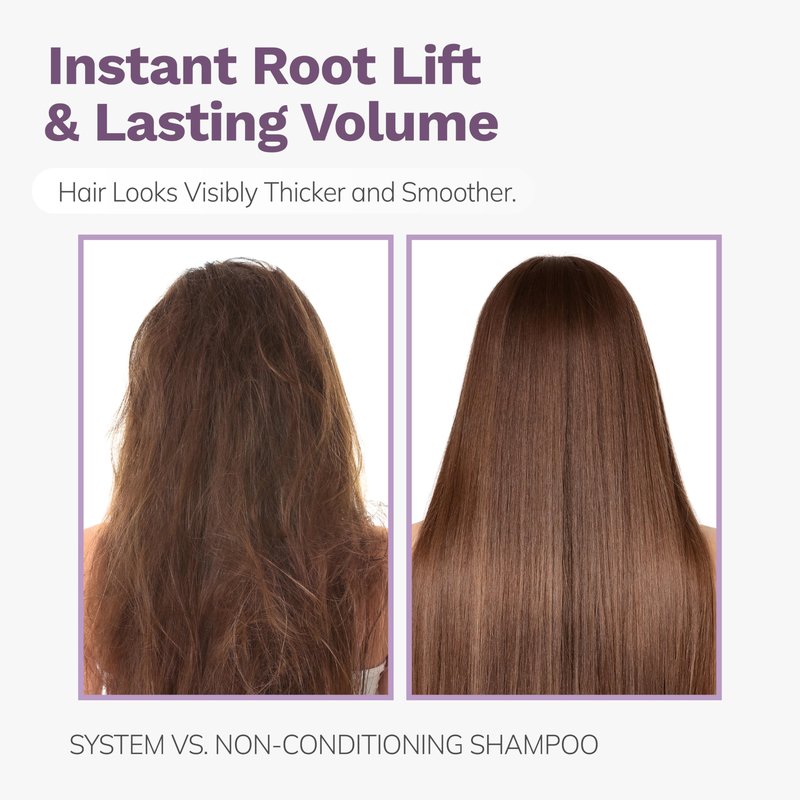 DORPANG Dandruff Shampoo for Oily Hair, Anti Dandruff and Oil Control Treatment Refresh Shampoo, Sulfate Free Daily Scalp Care, 355ml (12 fl oz) Floral Scent