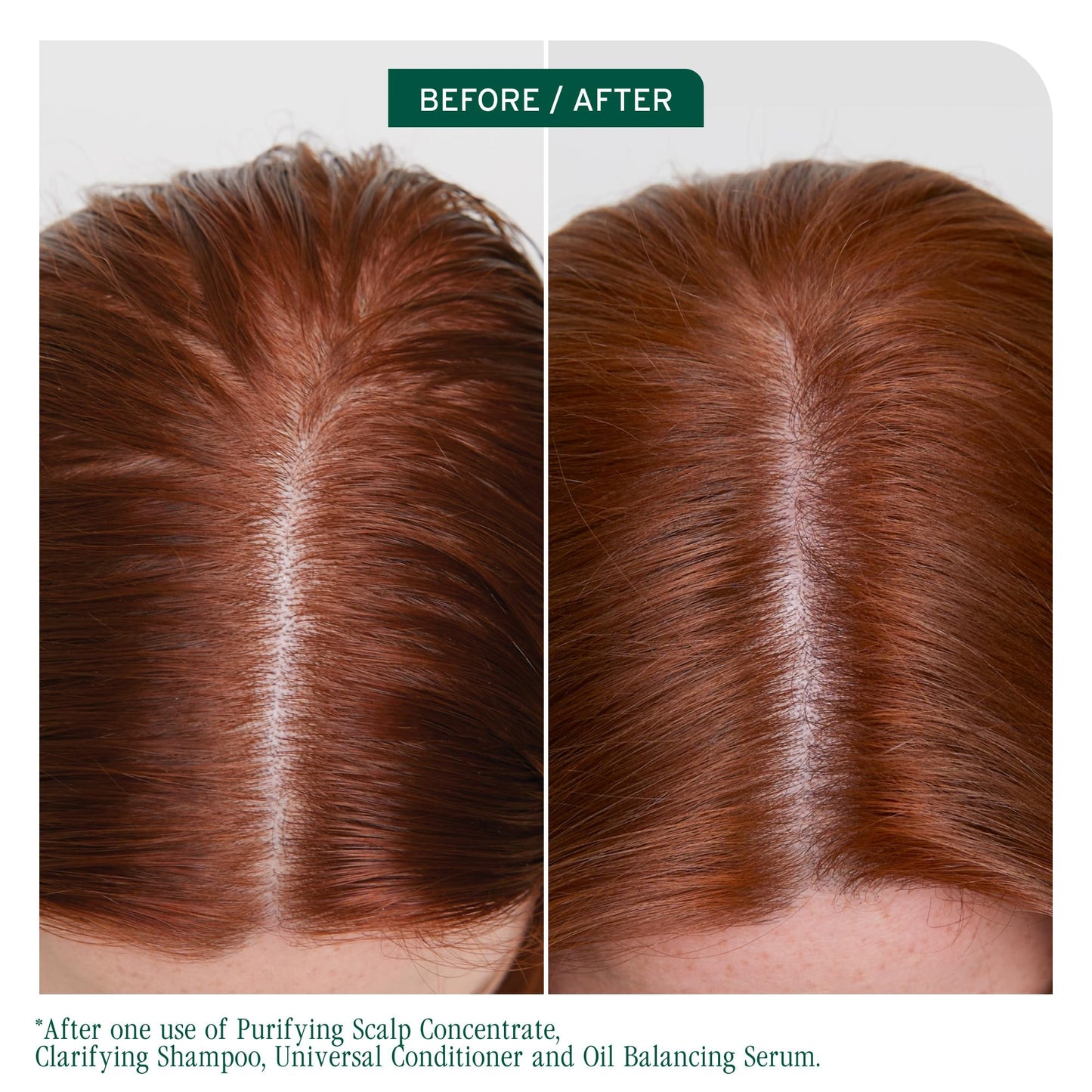 Biolage Scalp Sync Clarifying Shampoo - Residue & Buildup Remover, For Oily Scalp, Fermented Tea & Glycolic Acid, Vegan & Paraben-Free