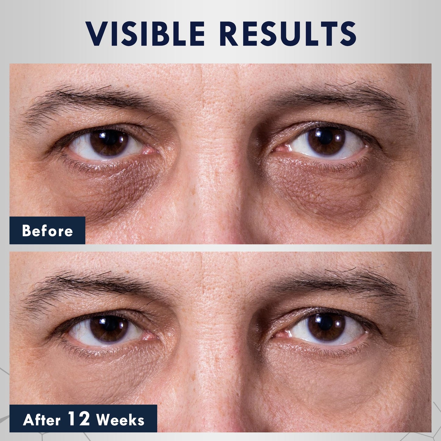 Eye Bags Treatment for Men: Caffeine Eye Cream for Dark Circles & Puffiness