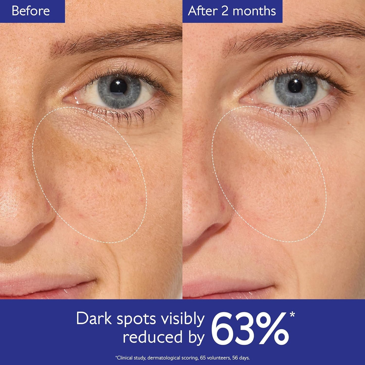 Vinoperfect Brightening Dark Spot Serum - 62x More Effective Than Vitamin C with Viniferine for Even Complexion