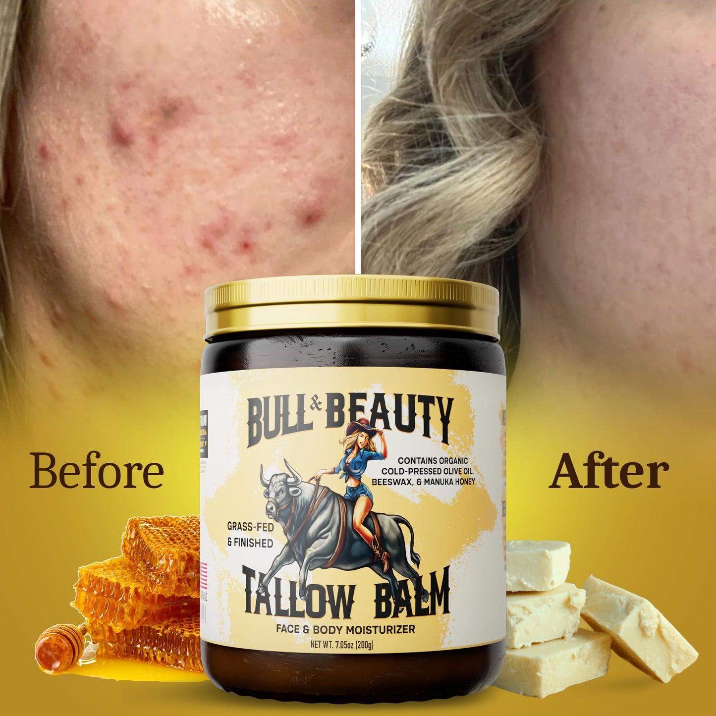 Bull & Beauty Organic Beef Tallow and Honey Balm 7.05oz Organic Beef Tallow for Skin - 100% Grass-Fed Unscented Beef Tallow Moisturizer for Skin & Face with Manuka Honey, Olive Oil & Beeswax
