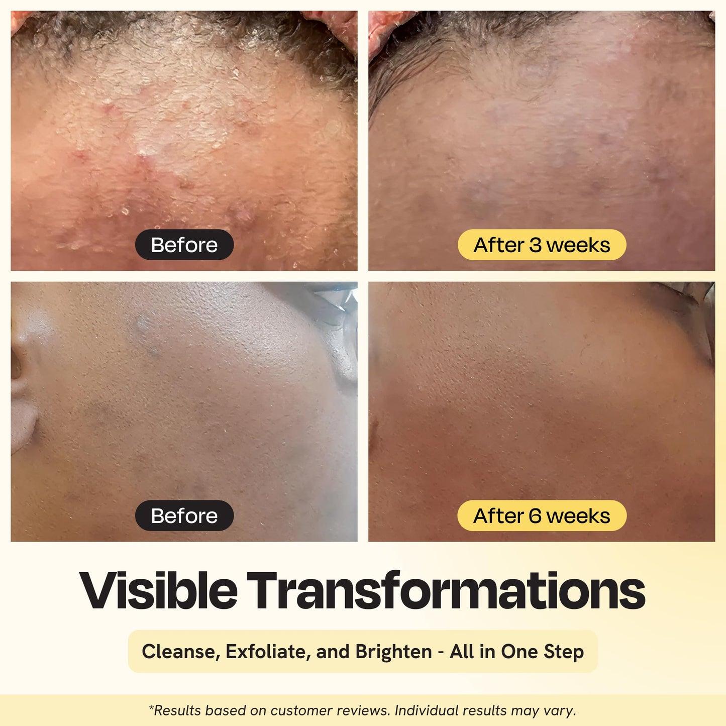 Gleamin Clarifying Brightening Cleanser - 2% Salicylic Acid with Vitamin C Facial Cleanser, PHA & AHA, Unclogs Pores, Gently Exfoliates for All Skin Types, Fragrance Free - 3.4 fl oz