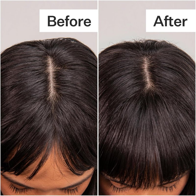 Fulvic Acid Volumizing Dry Shampoo - Plant-Based Natural Powder Spray for Oily Hair | Non-Aerosol, All Hair Types