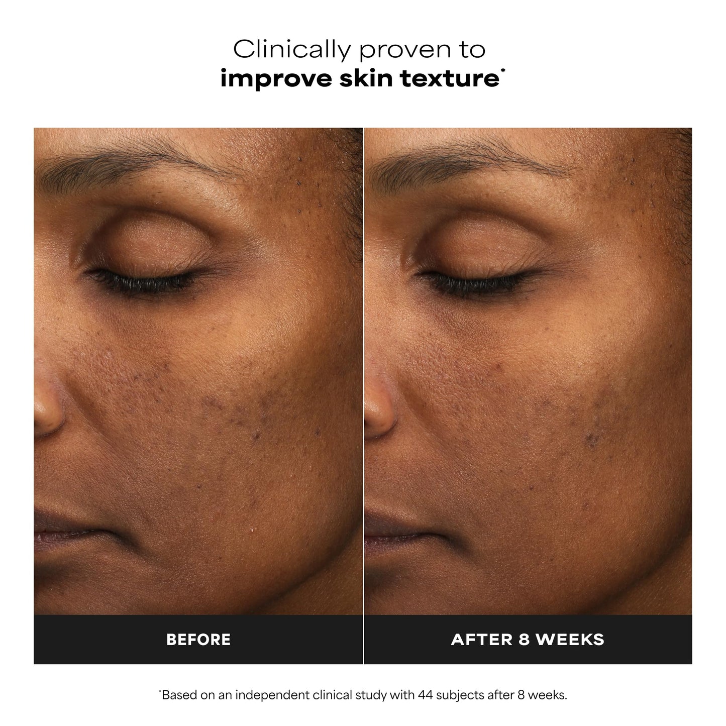 Paula's Choice 6% Mandelic + 2% Lactic Acid Liquid Exfoliant