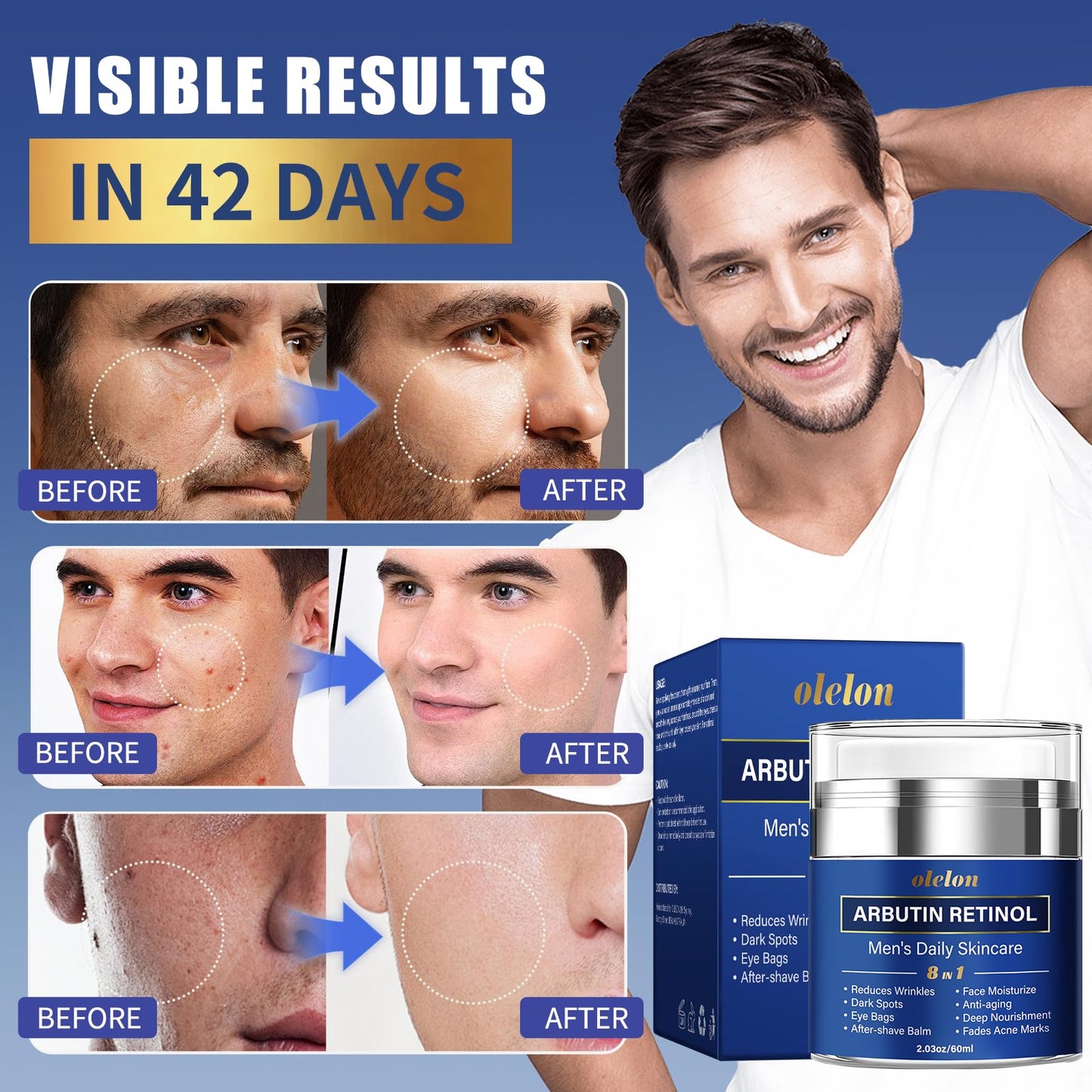 8-in-1 Face Cream for Men, mens face moisturizer with Alpha Arbutin, Retinol, Collagen and Hyaluronic Acid, Anti-Aging Face Cream for Men, Eye Bags Treatment & Wrinkle Cream 2.03oz