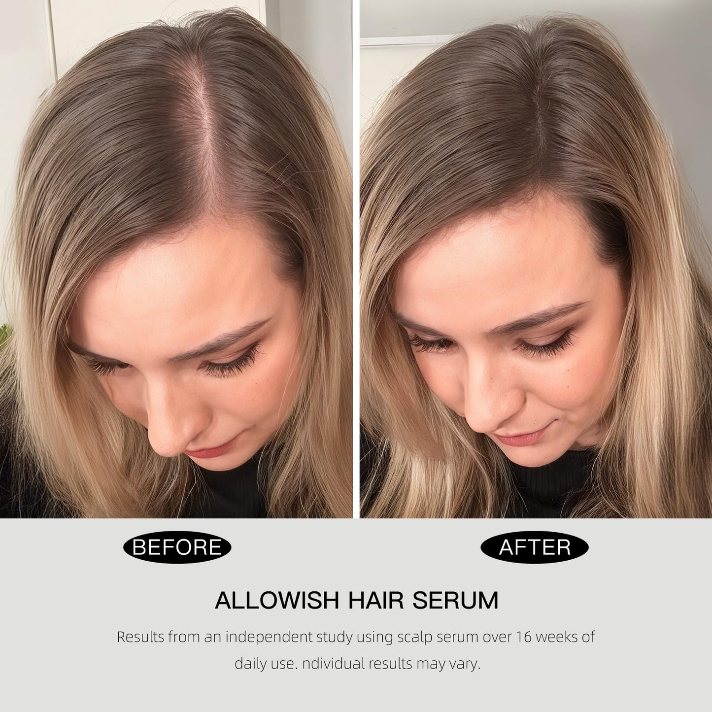 ALLOWISH Hair Growth Serum 95 ml - Rosemary Hair Thickening Serum with Biotin, Caffeine for Hair Thinning & Shedding – Promotes Healthy Scalp, Fuller, Nourish, Strengthens Roots