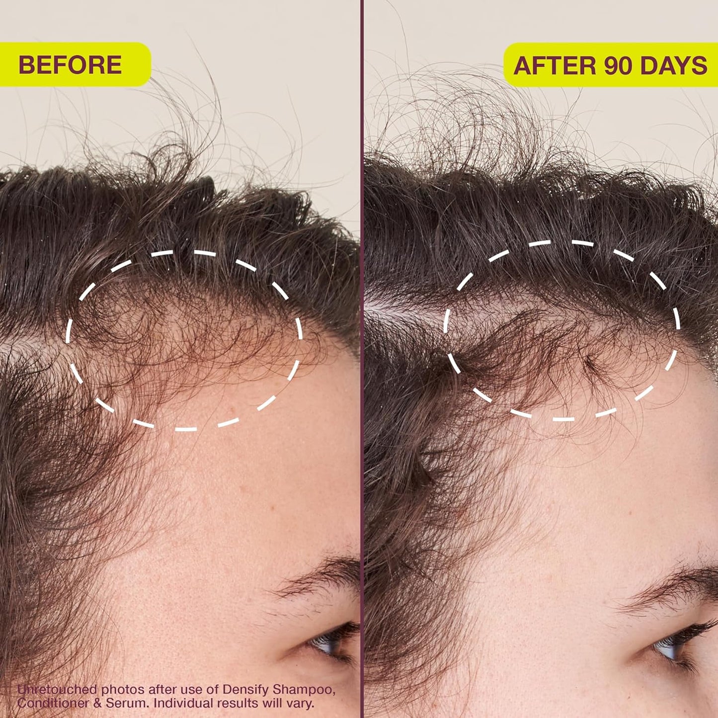 Densifying & Thickening Serum for Thinning Hair - 1oz | Nourishing Hair Growth Formula