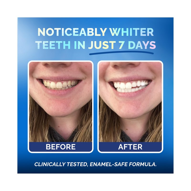 Whitening Strips for Sensitive Teeth 21 Treatments, Mint – Enamel Safe, Peroxide-Free Coconut Oil Teeth Whitening Strips with Natural Enzymes – Gentle White Stips for Sensitive Gums & Daily Oral Care