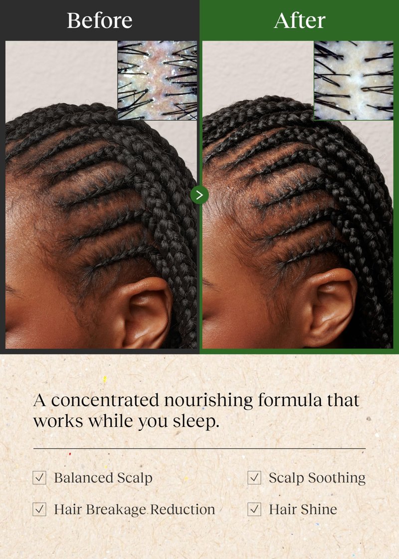 Bephor Braid Rev Scalp Sleeping Oil Balm, Korean Scalp Treatment, Balm-to-Oil Formula, Nourishing for Dry Scalp with Coconut & Shea Butter, Reduces Excess Sebum & Strengthens Hair Roots, 2.65 oz
