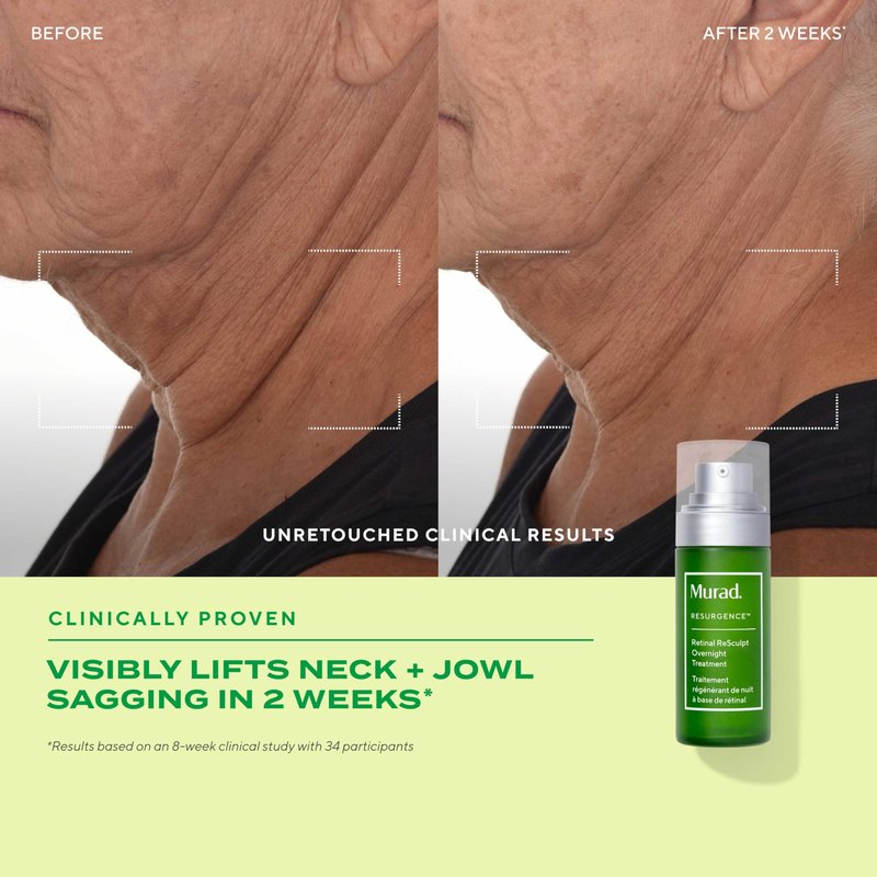 Murad Youth Renewal Retinol Trial Kit – 3-Piece Trial-Size Kit $102 Value - Anti-Aging Retinol Skincare Set - Serum for Face, Eye Serum, & Night Cream