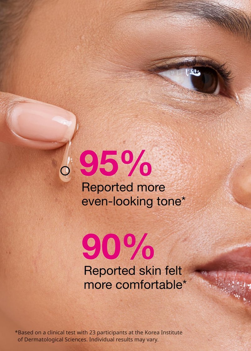 ISOI Blemish Care Up Serum for Face, Vegan Hydrating Serum for Smooth & Glass Skin Effect, Skin Barrier & Moisture Balance for Women, Arbutin & Rose Otto Oil, Korean Skin Care (1.18 fl. oz, 35ml)