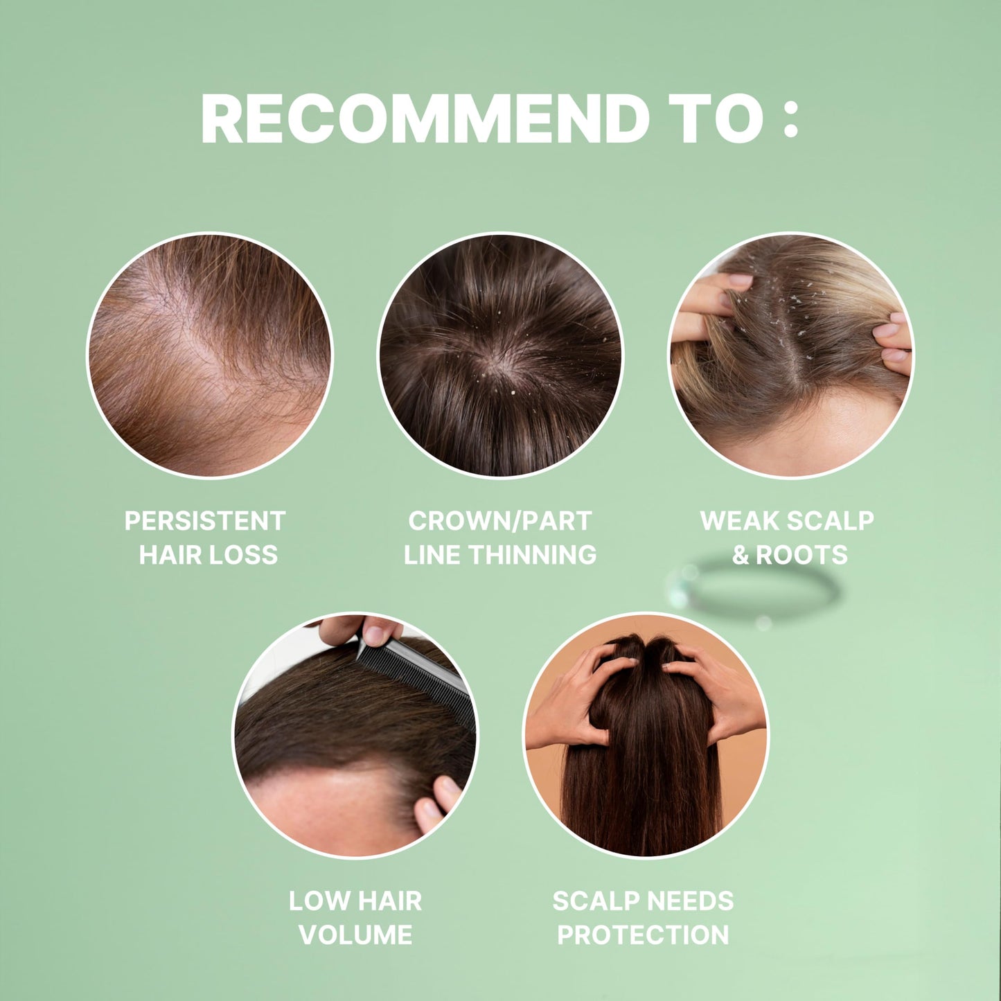 MINOXELL Korean Scalp Intensive Hair Growth Serum｜Biotin & Panthenol Leave-In Ampoule for Hair Loss, Thinning Hair, Scalp Hydration & Strengthening (2.02 fl oz)