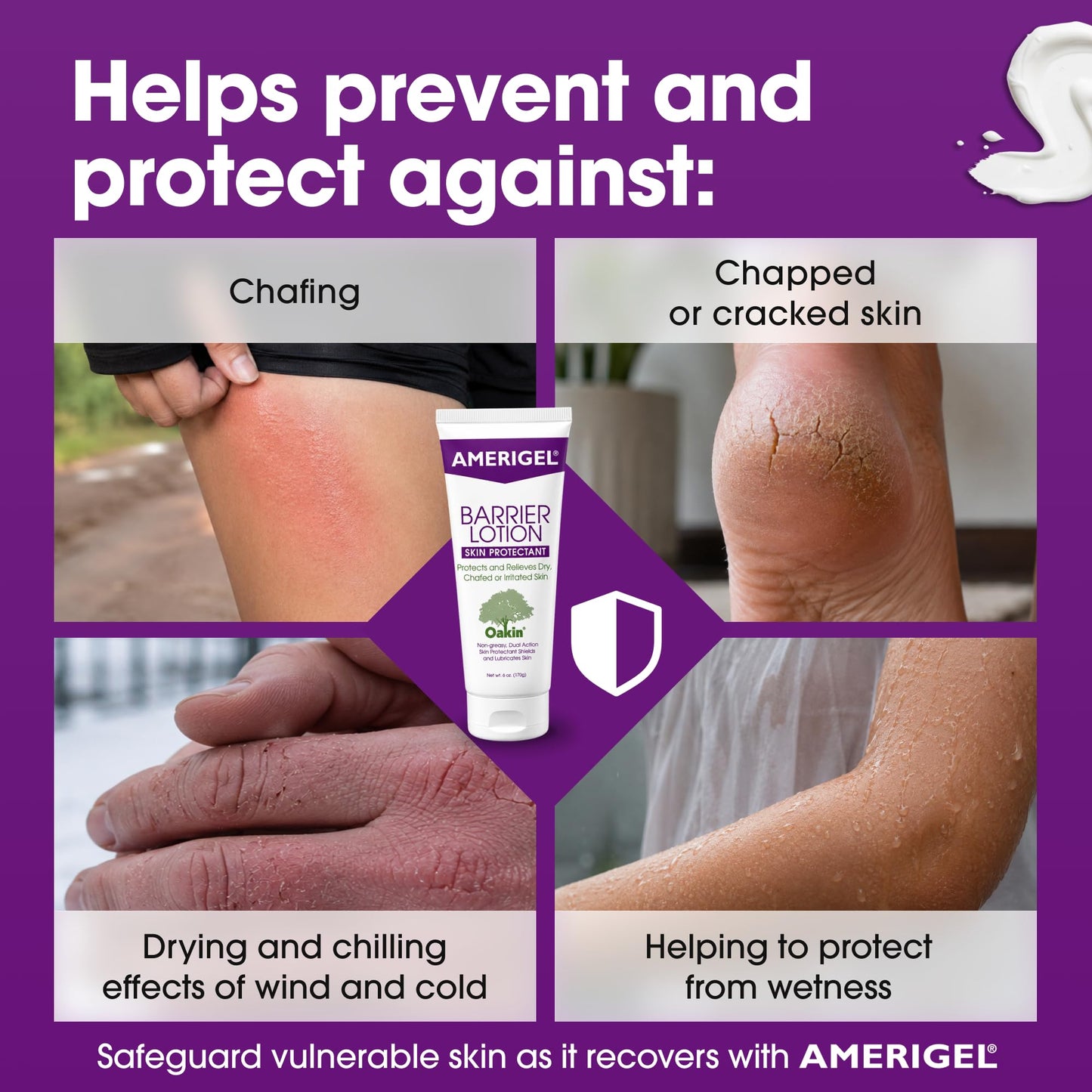 AMERIGEL Barrier Lotion (6 oz.) - Skin Protectant to Protect Chafed, Cracked, and Chapped Skin