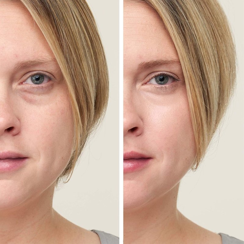 Jane Iredale CircleDelete Concealer - Creamy Under Eye Concealer with Vitamins A, C & E | Reduces Dark Circles & Fine Lines