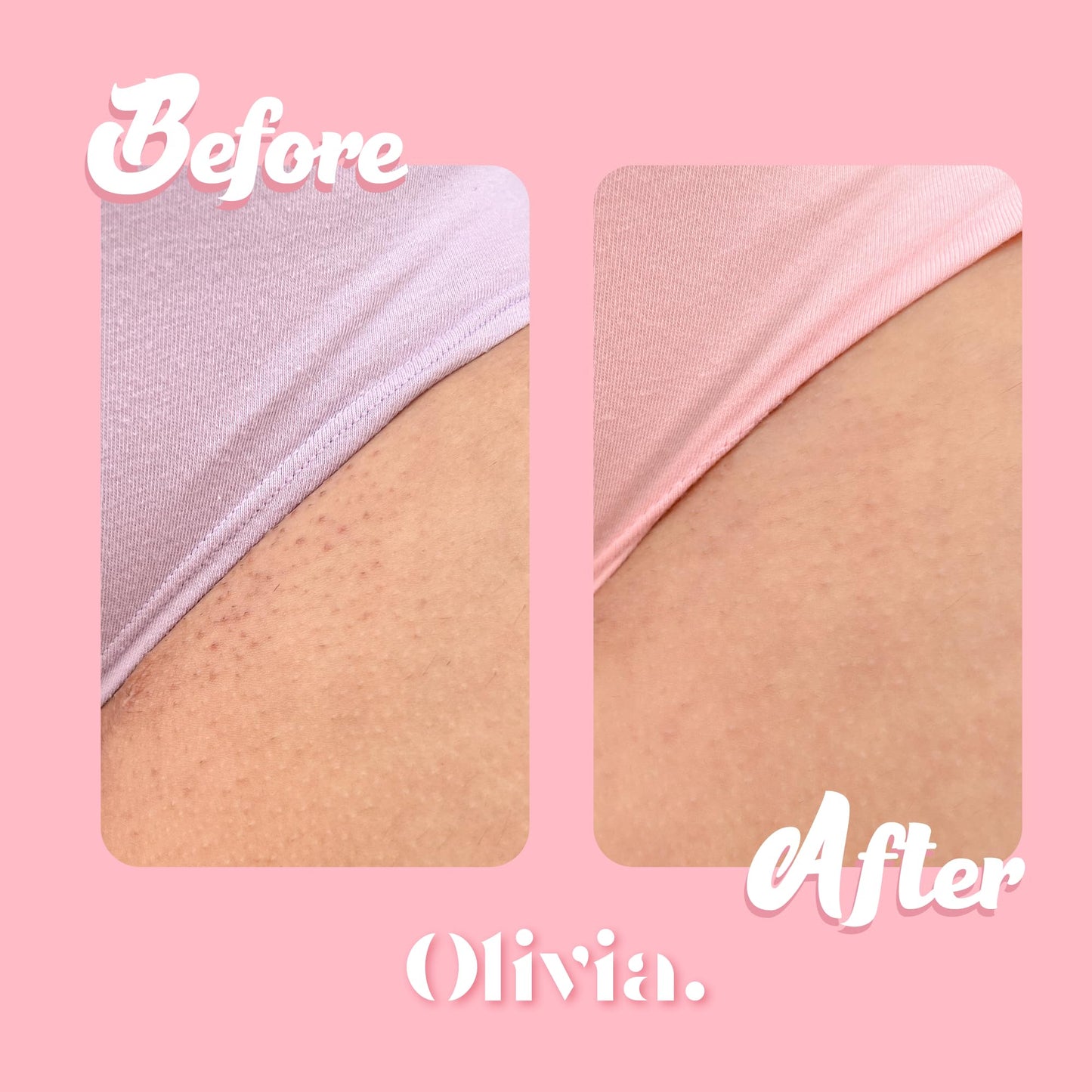 Olivia Beauty Ultra-Gentle Shaving Cream for Women - Organic Shave Butter, Intimate Bikini & Leg Shave Cream - Moisturizing & Fragrance-Free - Ideal for Sensitive Skin - 10 Fl Oz