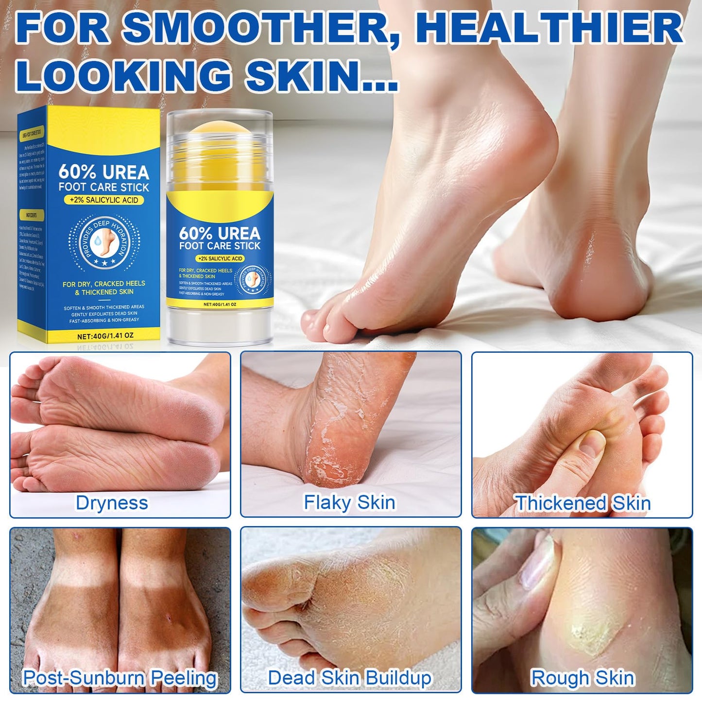 Urea Foot Care Stick - 60% Urea with 2% Salicylic Acid, 1.41oz - Moisturizer for Dry Cracked Feet,Knees,Elbows & Hands,Hydrating Cream,Callus Remover & Skin Softener,Soothes & Repairs Dry Skin