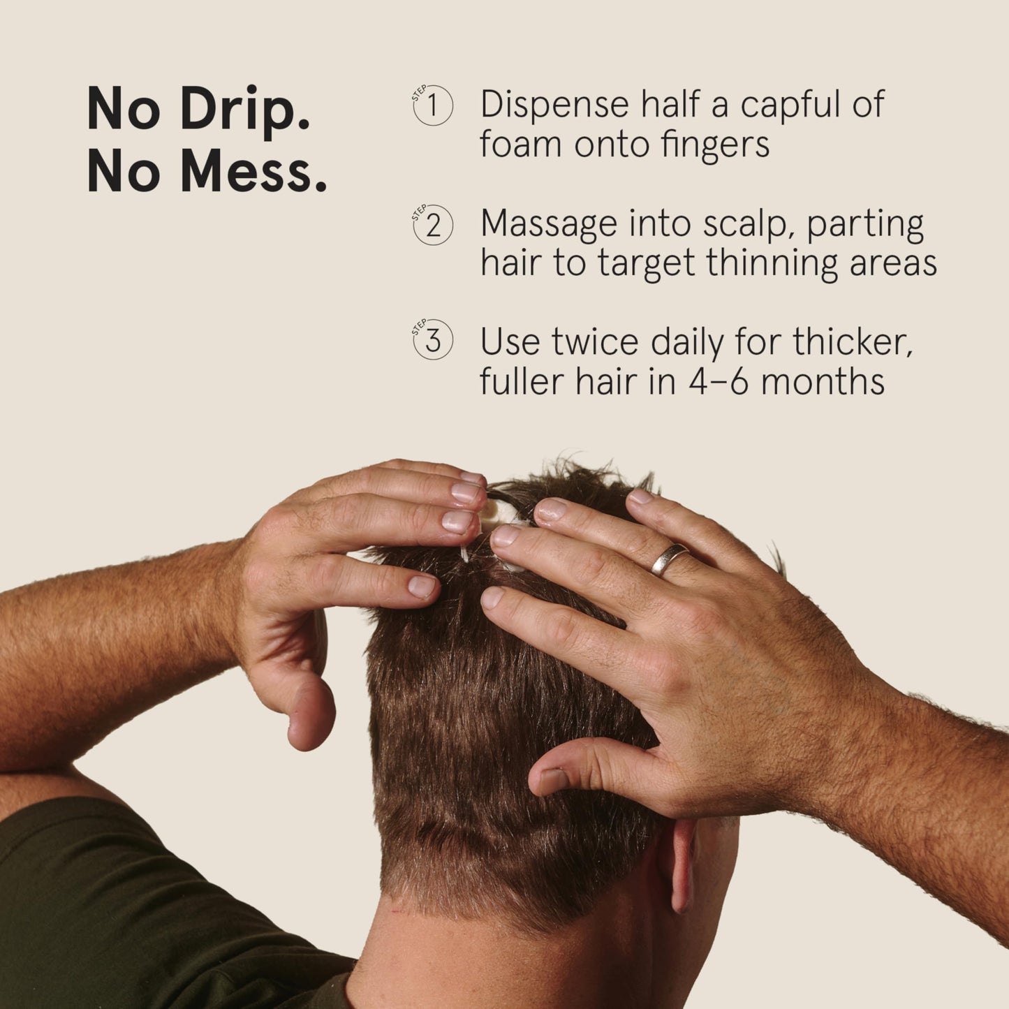Keeps Extra Strength Minoxidil for Men Topical Aerosol Foam & Hair Growth Serum