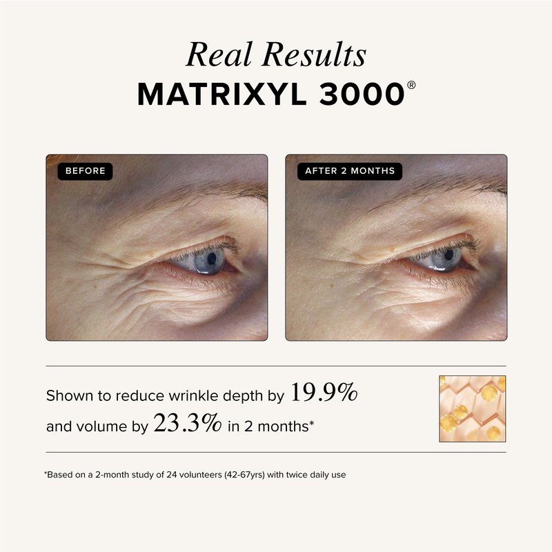 Asterwood Triple Repair Matrixyl 3000 + Argireline + Hyaluronic Acid + Vitamin C Serum for Face - Anti-Aging, Collagen Boosting, Hydrating - Fragrance-Free - 2 Fl Oz