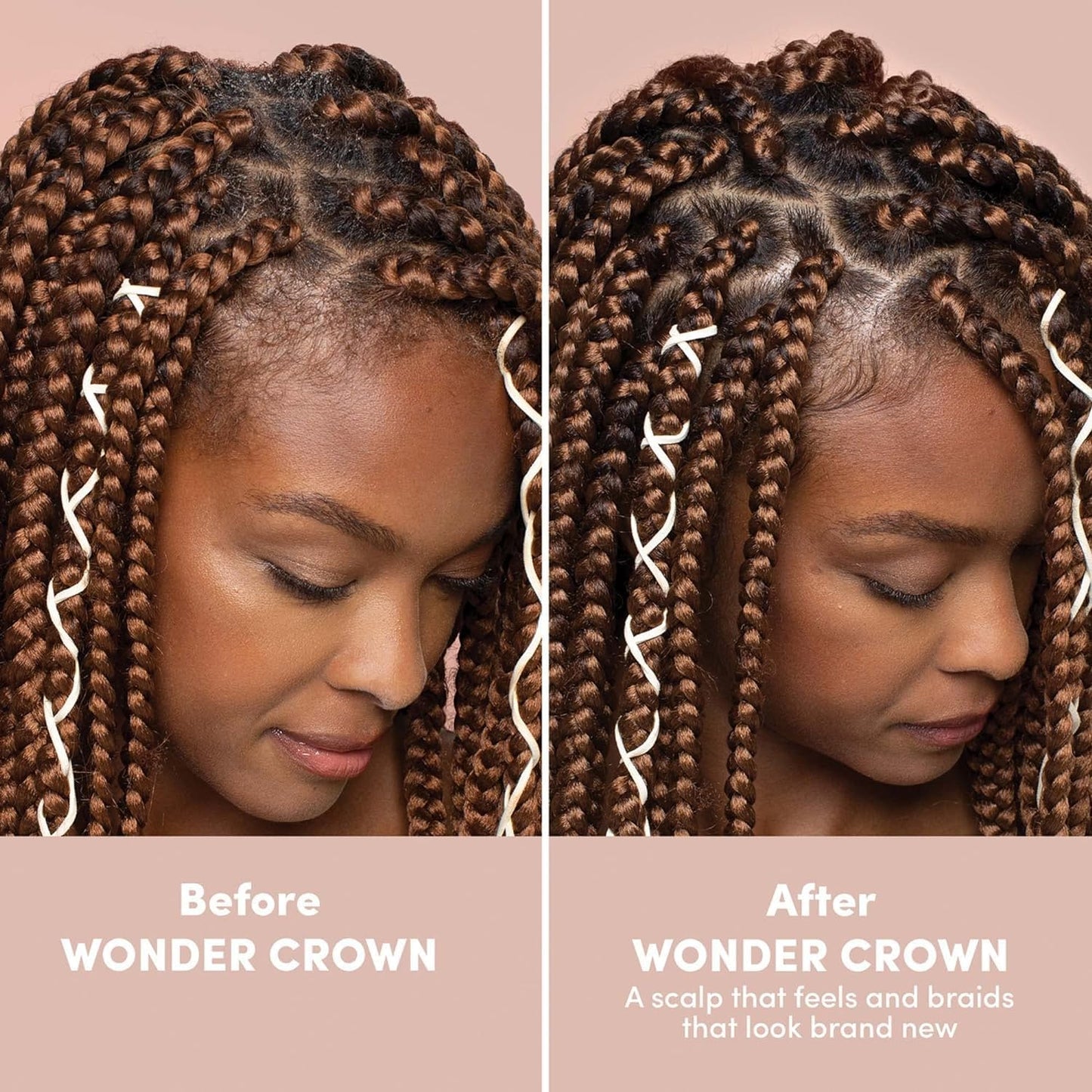 Mizani Wonder Crown Scalp Cleanser – For Dry Scalps