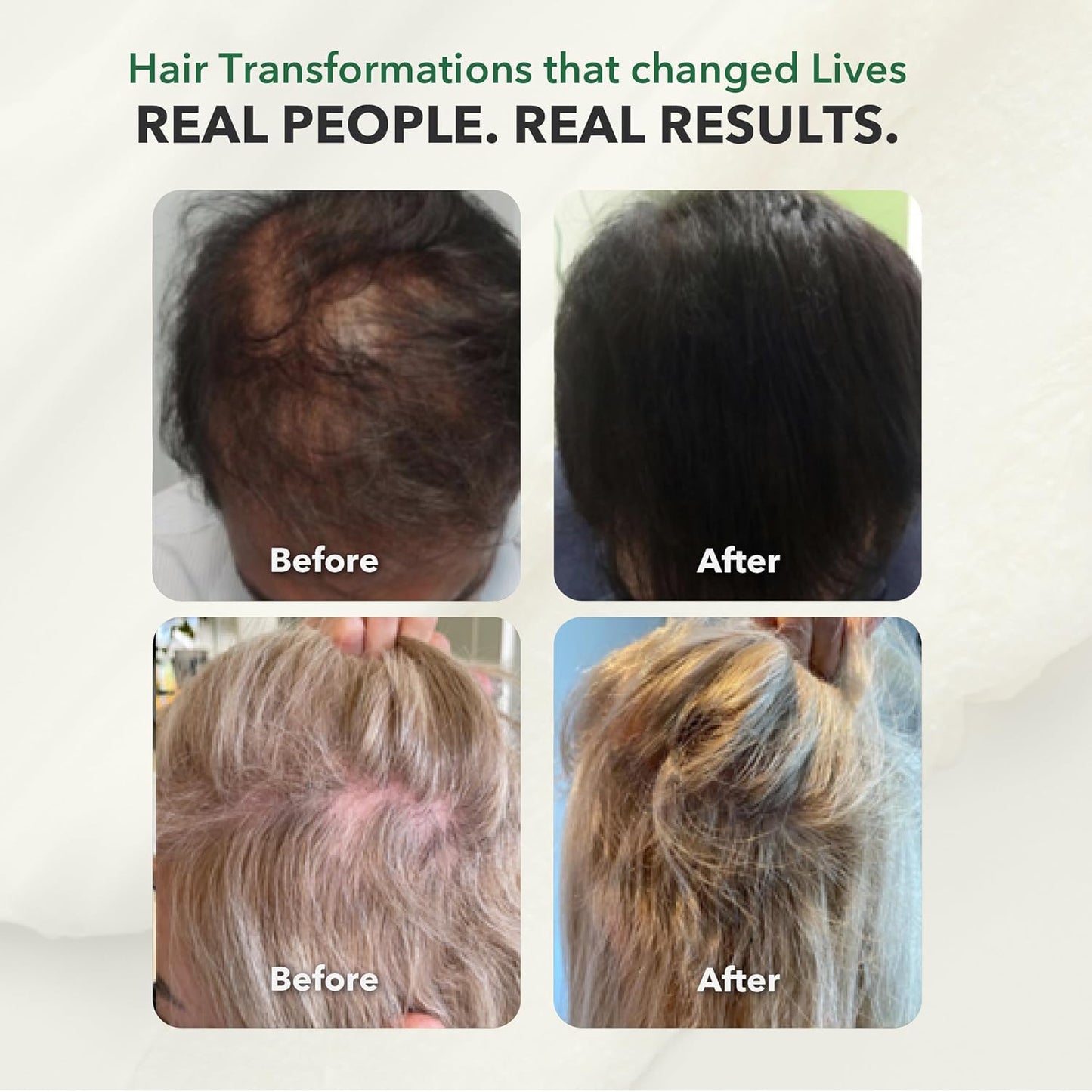 Ayurvedic Deep Conditioner for Dry, Damaged Hair - Volumizing Hair Growth Treatment | 100ml