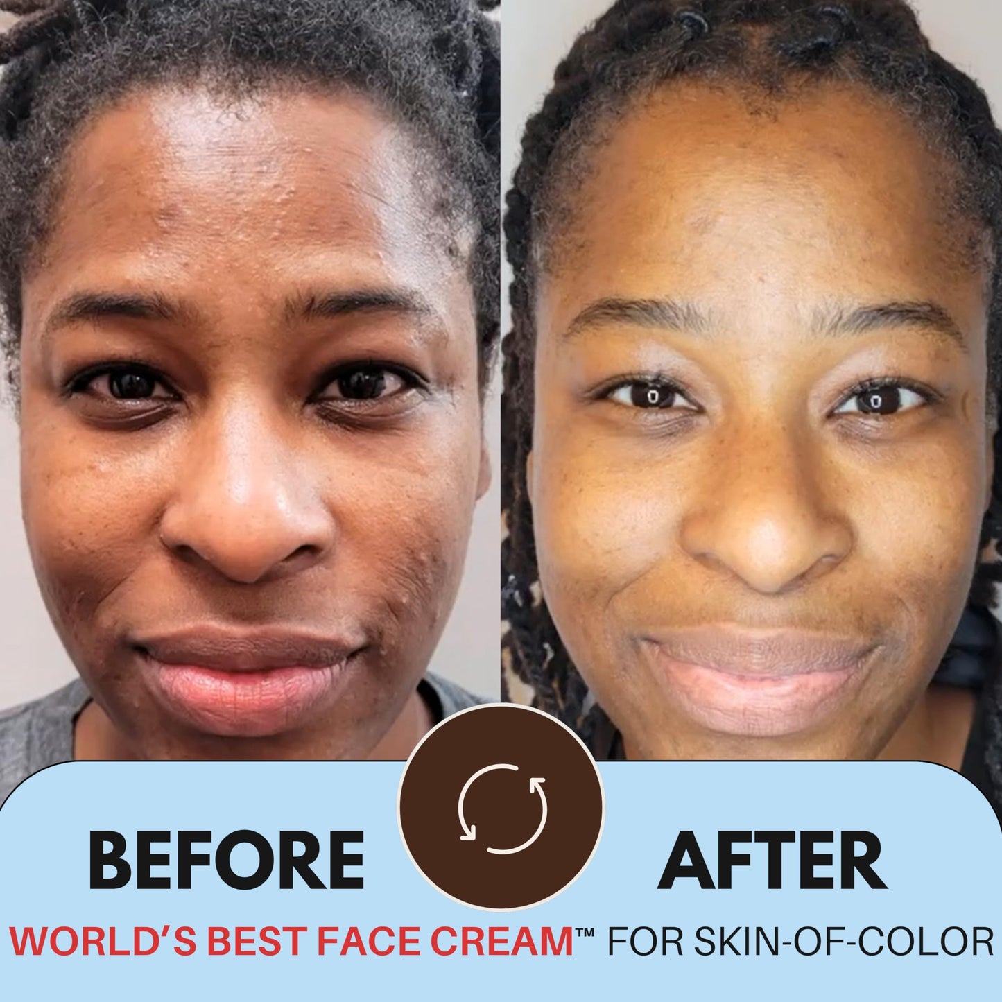 Beauty Of The Nile World’s Best Face Cream™ for Skin-of-Color, Anti Aging Reverse Signs of Aging Hydrates Niacinamide Squalane Hyaluronic Acid, 2 oz