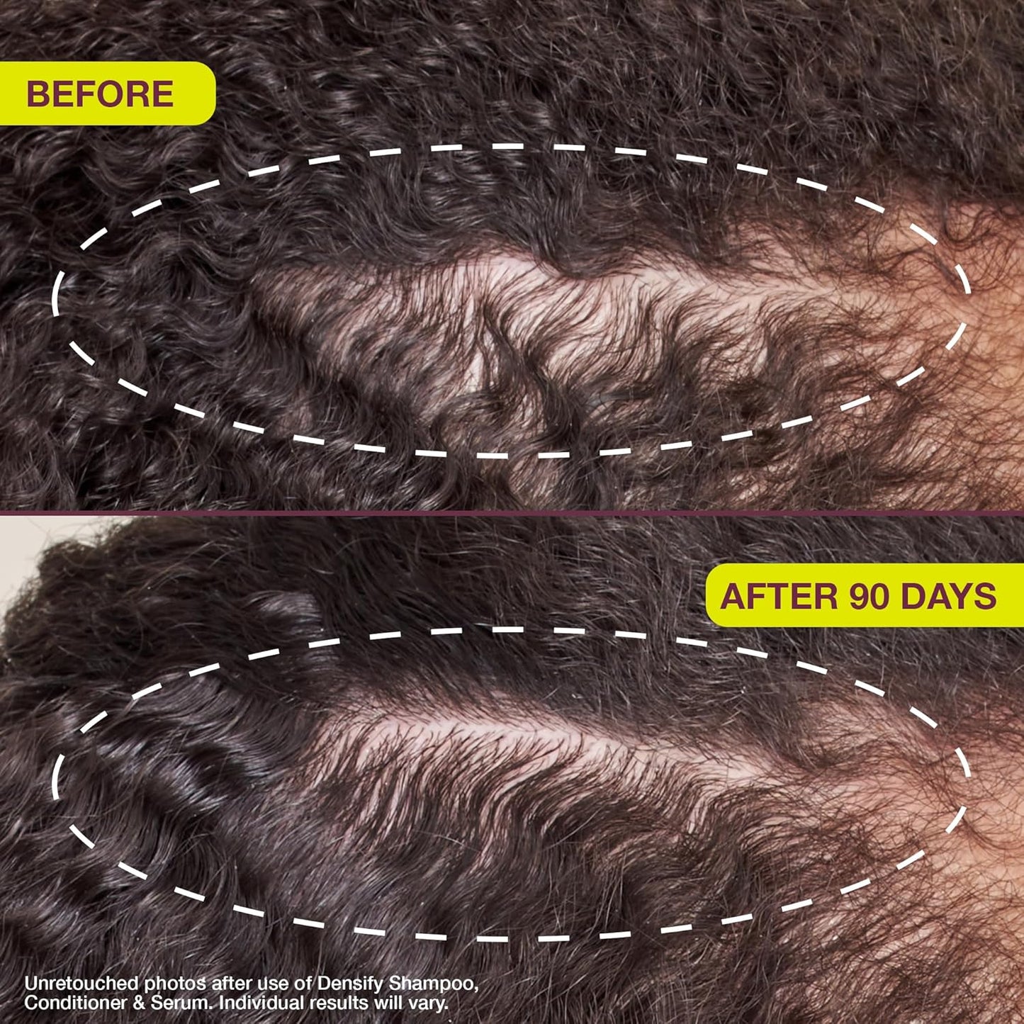 Densifying & Thickening Serum for Thinning Hair - 1oz | Nourishing Hair Growth Formula