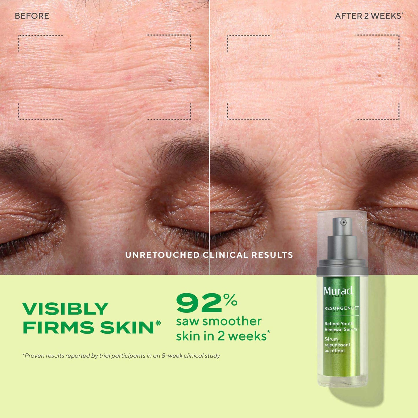 Murad Rejuvenate + Replenish w/ Healthy Skin - 3-Piece Full Sized Set ($213 Value) - Regimen for Total Skin Health - Ess-C Cleanser 6.75Fl Oz, Retinol Serum 1.0Fl Oz, Hydro Dynamic Moisture 1.7Fl Oz