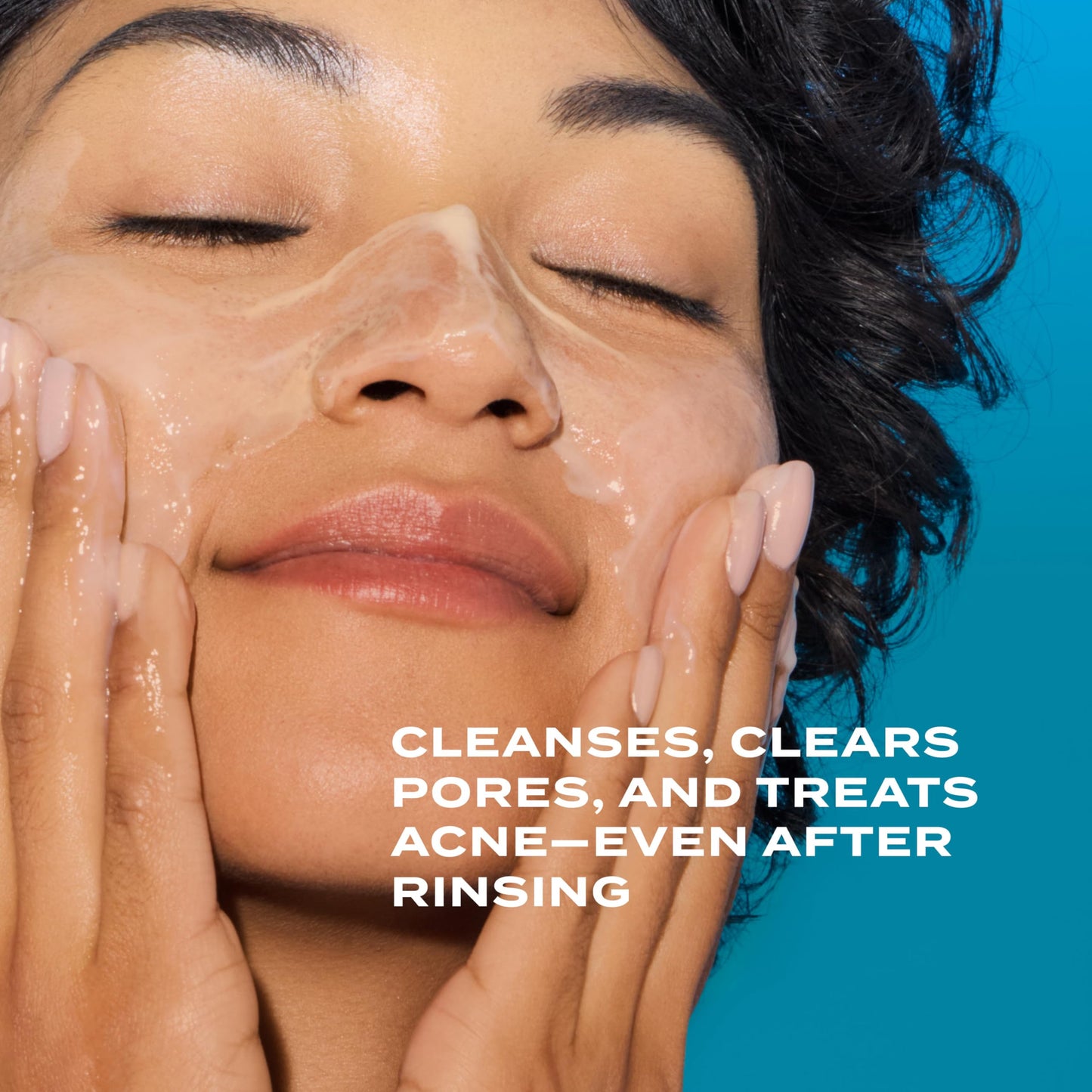 Murad Acne Treat & Control Combo - Deep Relief Acne Treatment and Clarifying Cleanser with Salicylic Acid and Green Tea for Maximum Strength Clearing and Preventing Deep Painful Breakouts, Set of 2