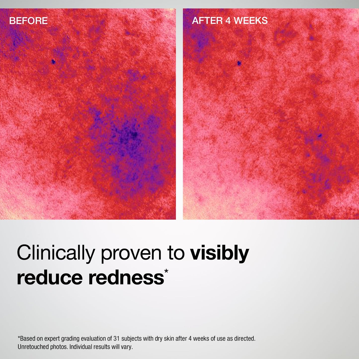 StriVectin Barrier Restore + Soothing Ceramide Cream with Ceramides + Niacinamide, Hydrating & Soothing, No Fragrance, Turmeric, Face & Neck Moisturizer