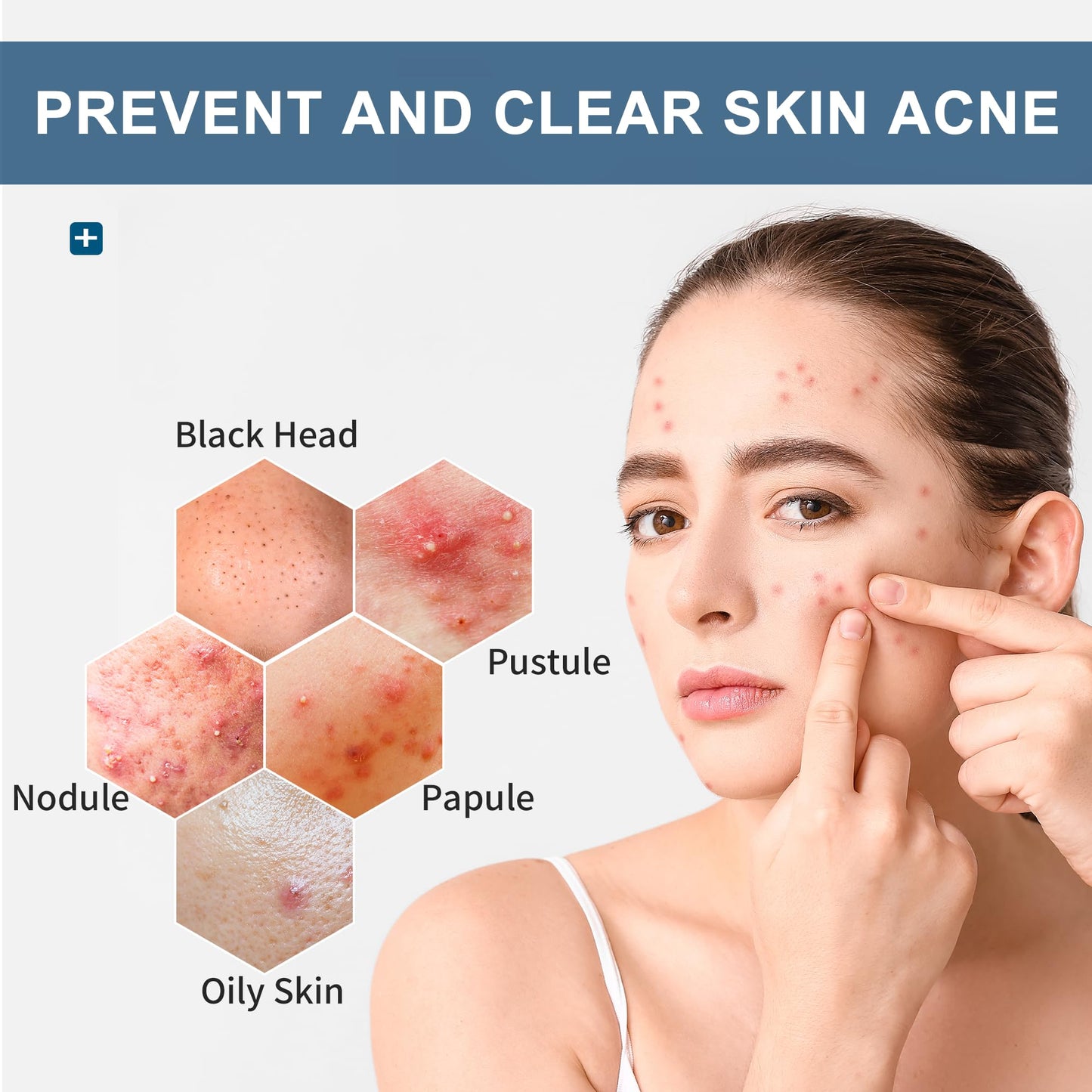 Natouch Acne Wipes for Face & Back, Acne Treatment Wipes with Salicylic Acid, Acne Scars and Dark Spot Remover with Natural Essential Oil for Face, Body, Back, and Butt