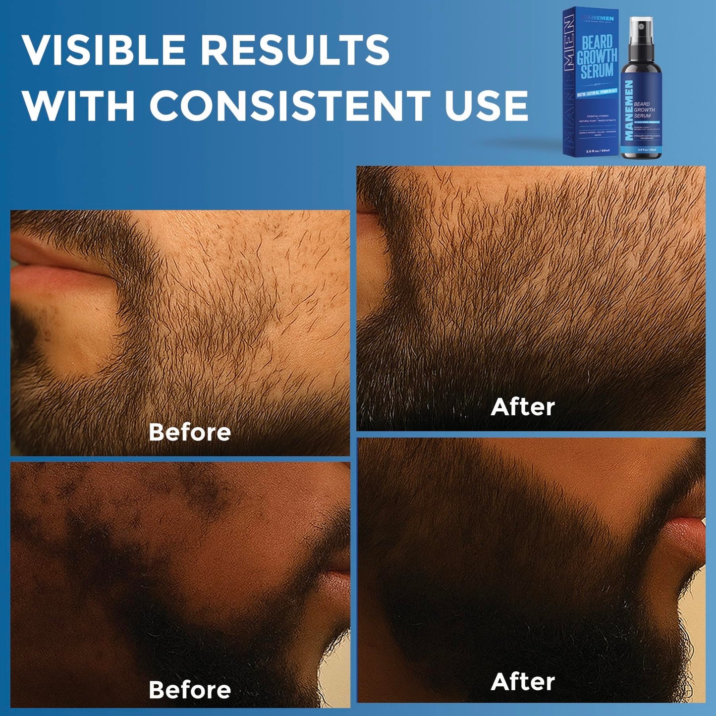 Manemen Beard Growth Serum Spray- Biotin, Castor Oil, Vitamin B5 & B12 - Natural Hair Regrowth Beard Oil Formula for Thicker, Fuller, Stronger Beard - Stimulates Hair Follicles & Supports Fast Growth