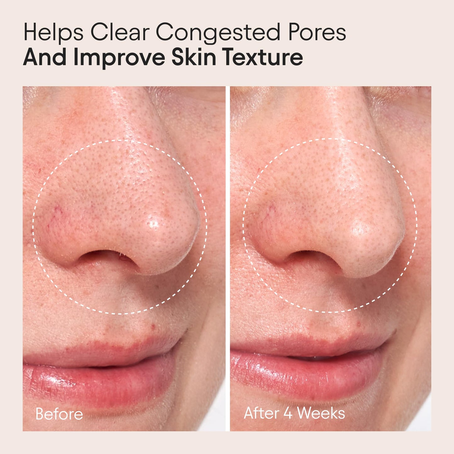 ALPYN Clarifying Facial Oil with Retinol & Pink Algae | Clear Congestion, Smooth Fine Lines, Improve Texture & Glow | 1 Fl Oz / 30 ml