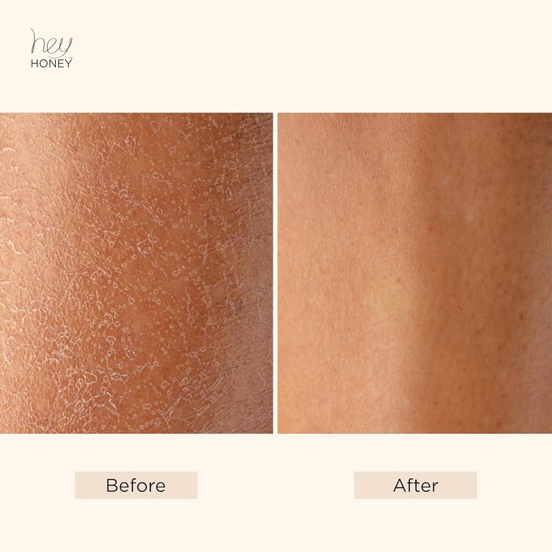Mango & Honey Body Lotion - Water-Free Formula with Hyaluronic Acid & Ceramides for Dry Sensitive Skin | 6.7 oz