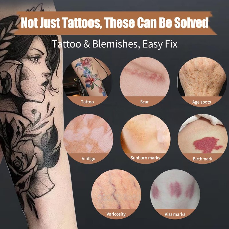 VANERIA Body Concealer, Tattoo Cover Up, Tattoo Cover Up Makeup Waterproof, Suitable For Scars, Birthmarks, Vitiligo and All Kinds Of Skin Tone, 3 Colors, 283g