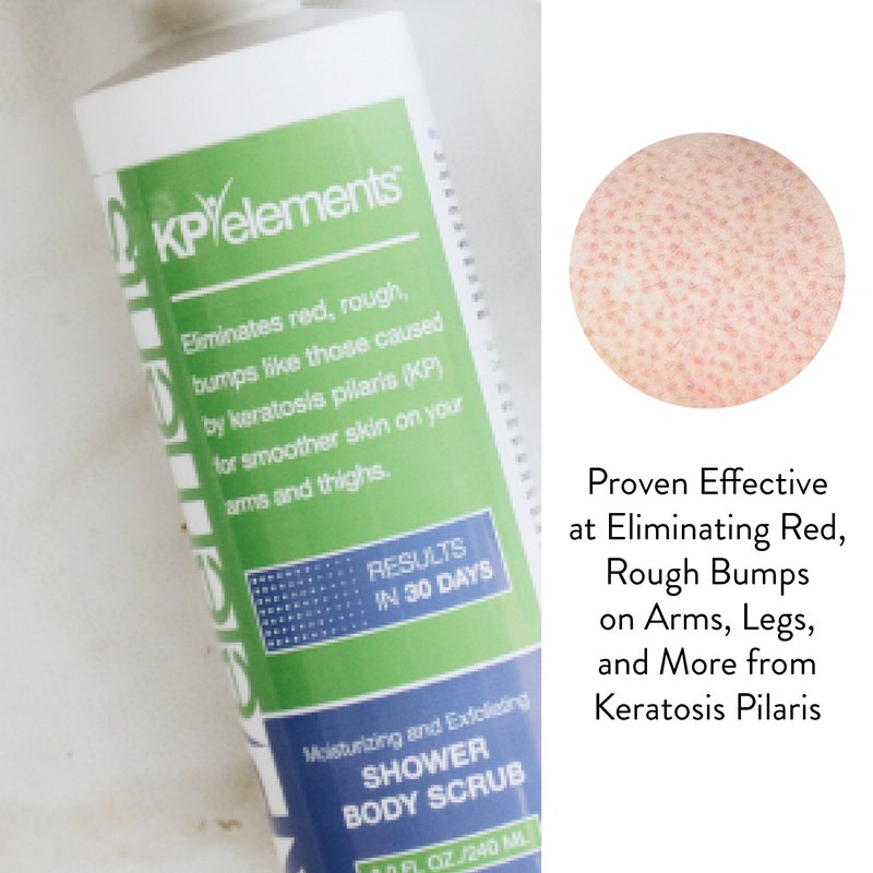 KP Elements Body Scrub (8 fl oz) | Keratosis Pilaris Treatment | Exfoliating Body Scrub and Body Moisturizer for Dry Skin | Helps Reduce Red Bumps | Body Skin Care Product for Men and Women