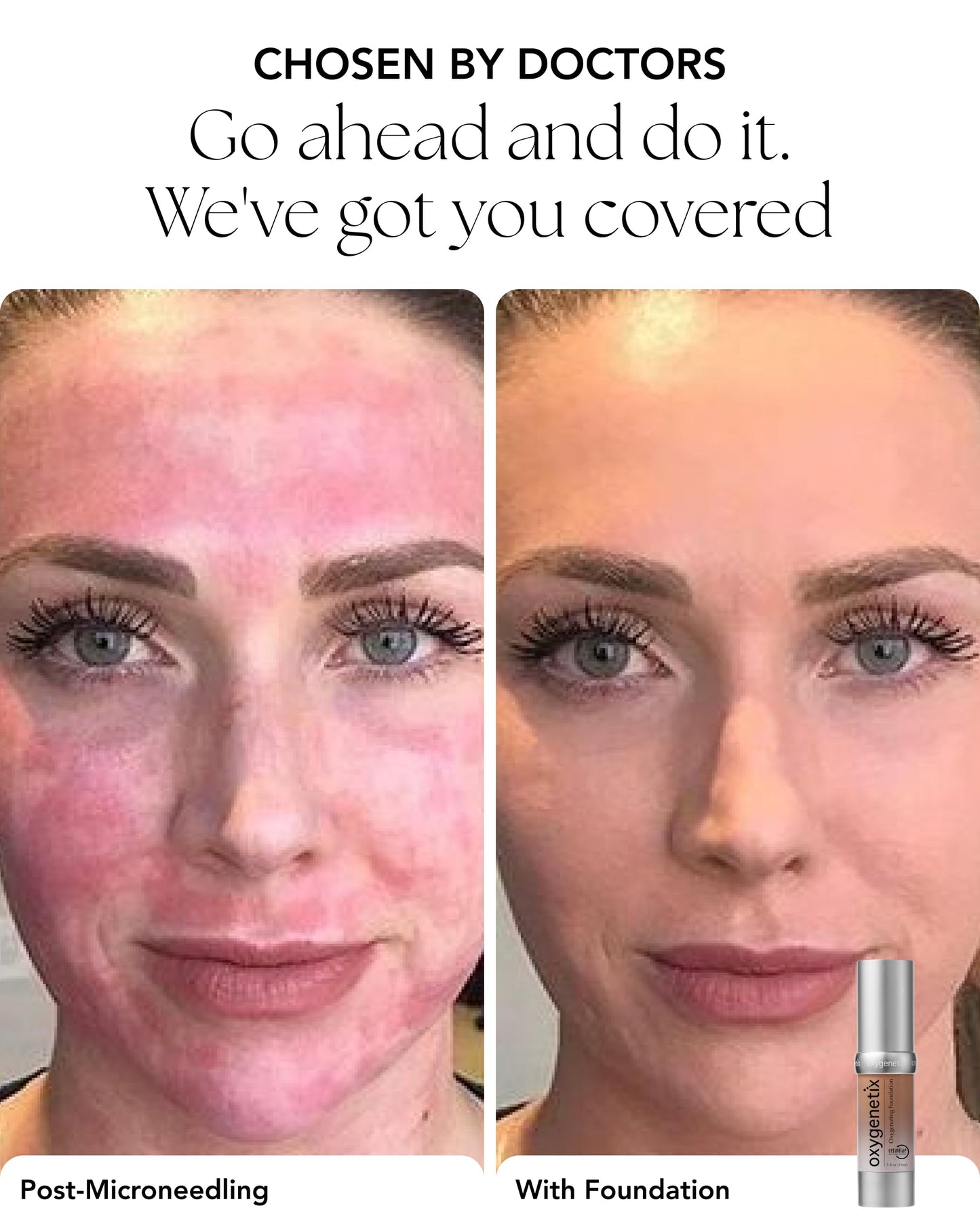 Oxygenetix Oxygenating Foundation – Beige | Breathable Makeup for Face | Buildable Coverage with Weightless Feel | Longwear Foundation for Women | Safe for Sensitive or Laser-Treated Skin