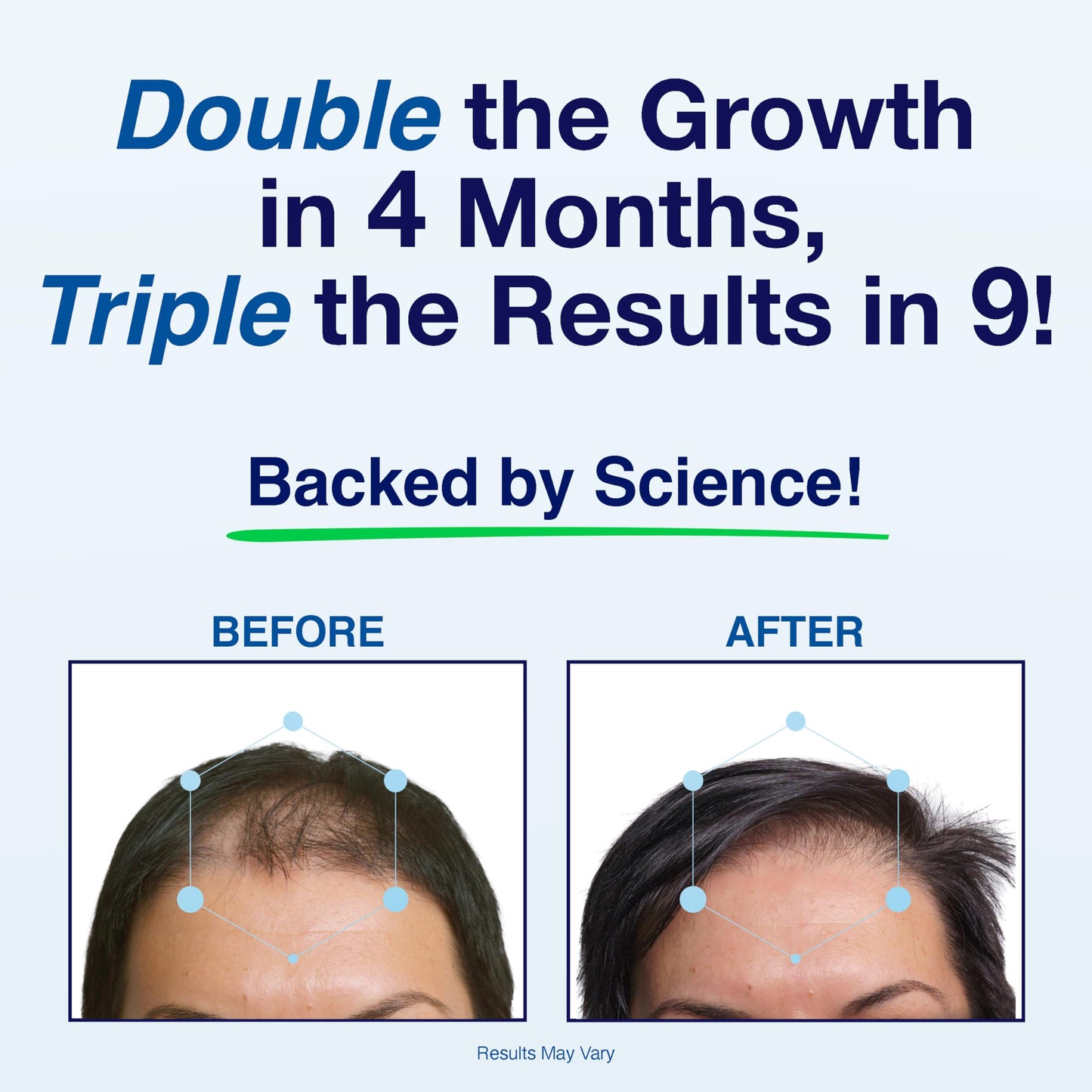 Patented Hair Growth Vitamins for Women & Men | Clinically Proven Hair Loss Supplement for Visibly Thicker Fuller Hair | Dr. Recommended Hair Vitamins for Hair Loss and Thinning | 1 Month Supply