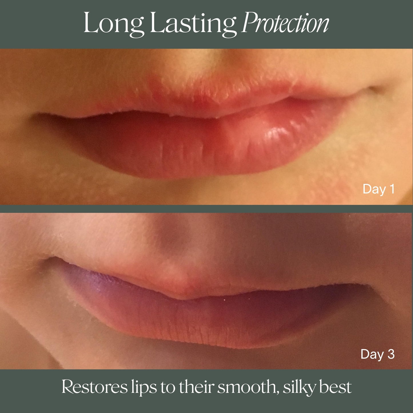 Doctor Rogers Lip Balm, Ultra Hydrating Lip Treatment, Clean Fragrance-free Lip Moisturizer for Soft Lips, Hypoallergenic, 0.15oz (4.25g)