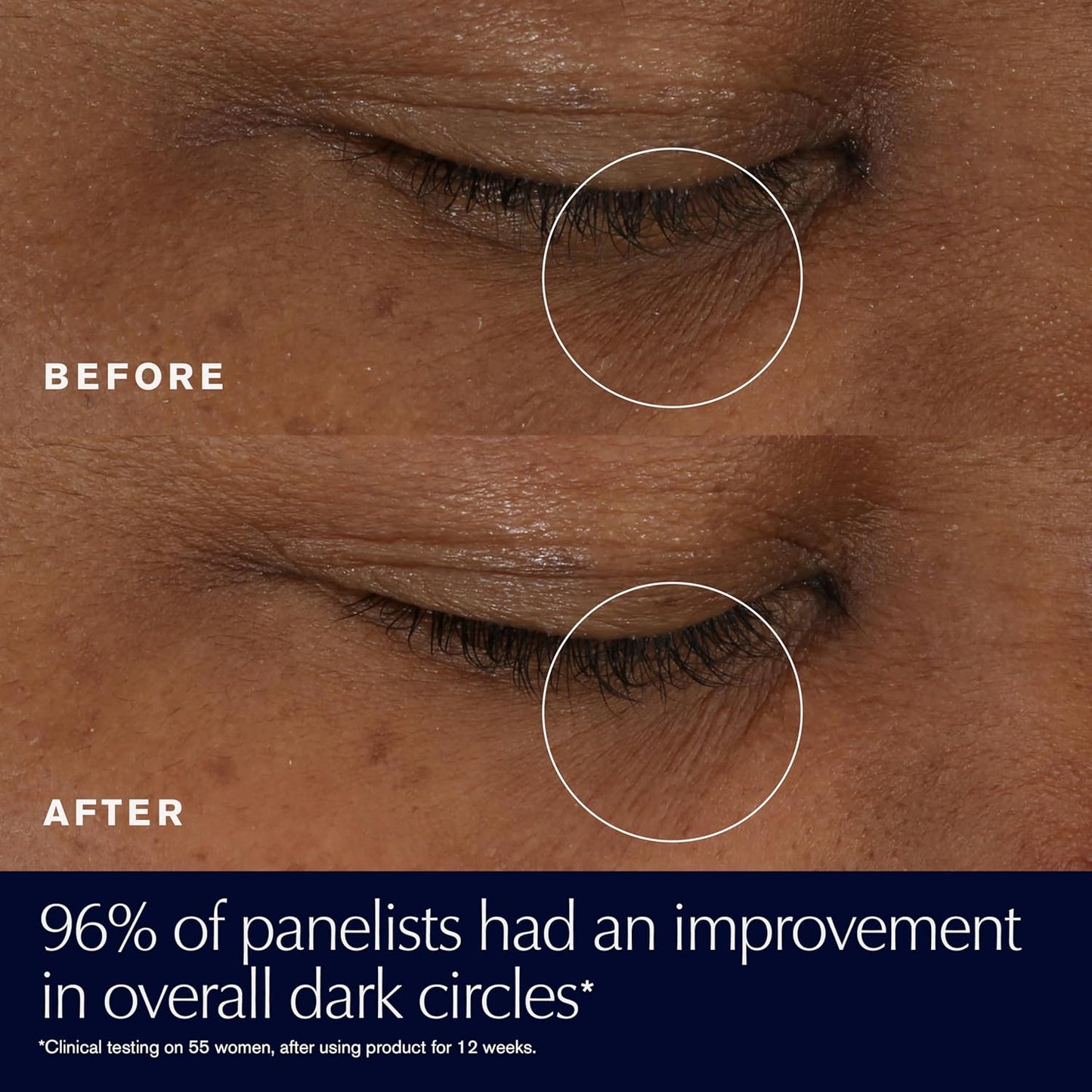 Estée Lauder Advanced Night Repair Eye Gel-Cream - Synchronized Multi-Recovery for Dark Circles