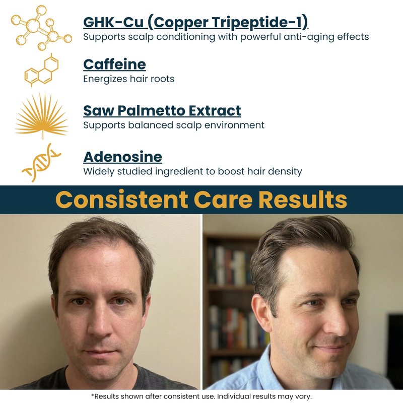 Seraphime Copper Peptide Serum for Hair Growth - Caffeine, Niacinamide, Rosemary Oil, Saw Palmetto Hair Density Serum, Topical Tripeptide Scalp Care for Hair Thinning, Women & Men 1 fl oz