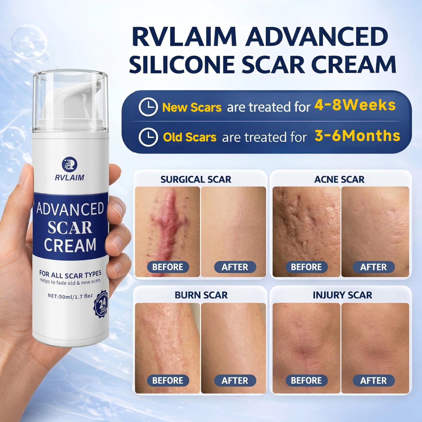 Rvlaim Silicone Scar Cream, Advanced Scar Removal Gel for Old & New Scars, Improves Color & Texture for Post-Surgery, C-Section & Acne Scars, Fast-Drying Non-Greasy Formula, 1.7 fl oz