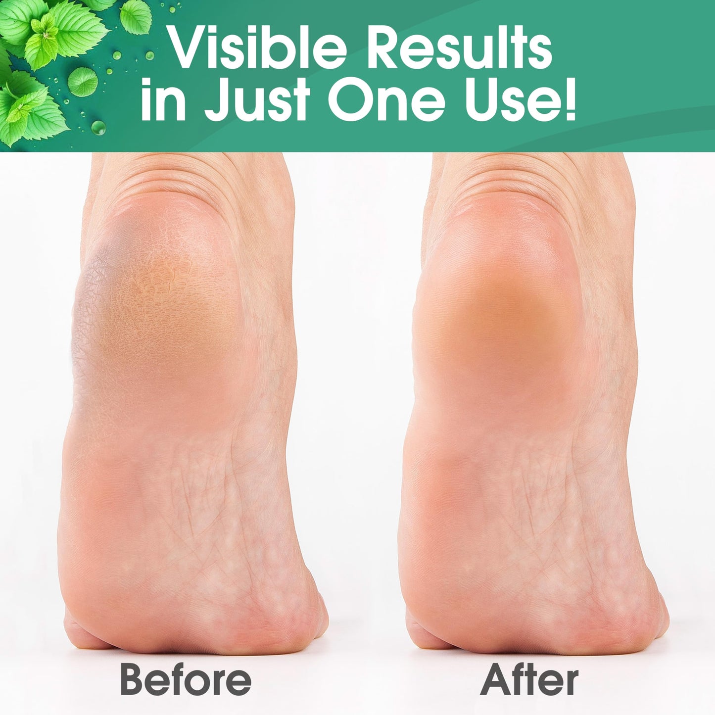 DeEnti Callus Remover for Feet, Extra Strength Foot Callus Remover Gel, 128oz Gallon Salon Grade Bulk Pedicure Supplies for Dry Skin, Cracked Heel, Professional Strength Foot Care, Cool Mint