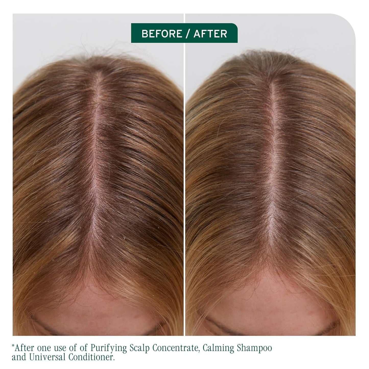 Biolage Scalp Sync Calming Shampoo & Conditioner Set - Hydrating Formula for Dry, Irritated Scalp | 33.8 Fl Oz