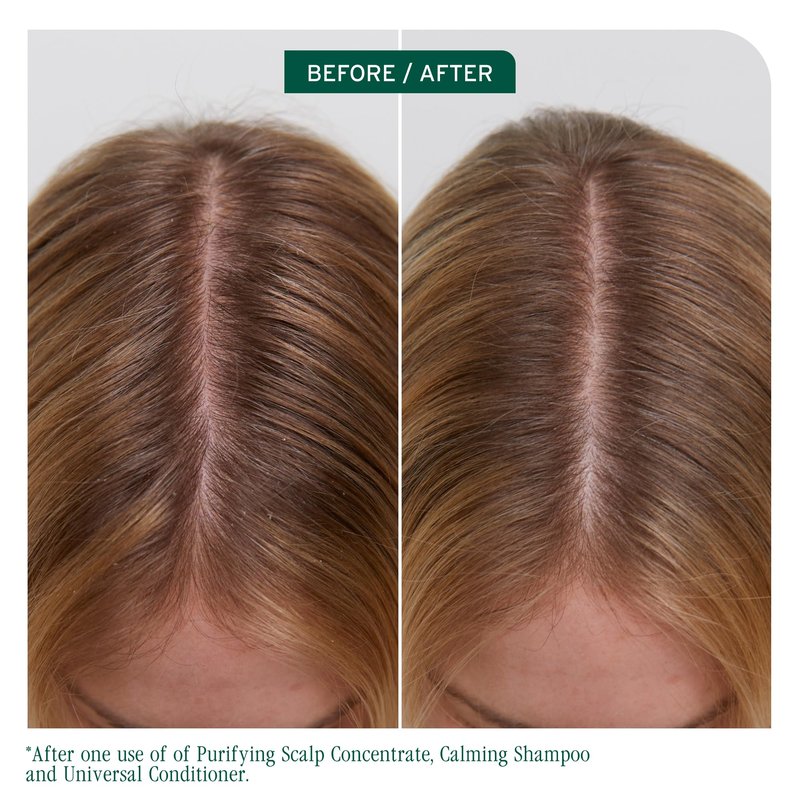 Biolage Scalp Sync Clarifying Shampoo and Universal Conditioner Set - Residue & Buildup Remover, For Oily Scalp, Fermented Tea & Glycolic Acid, Vegan & Paraben-Free