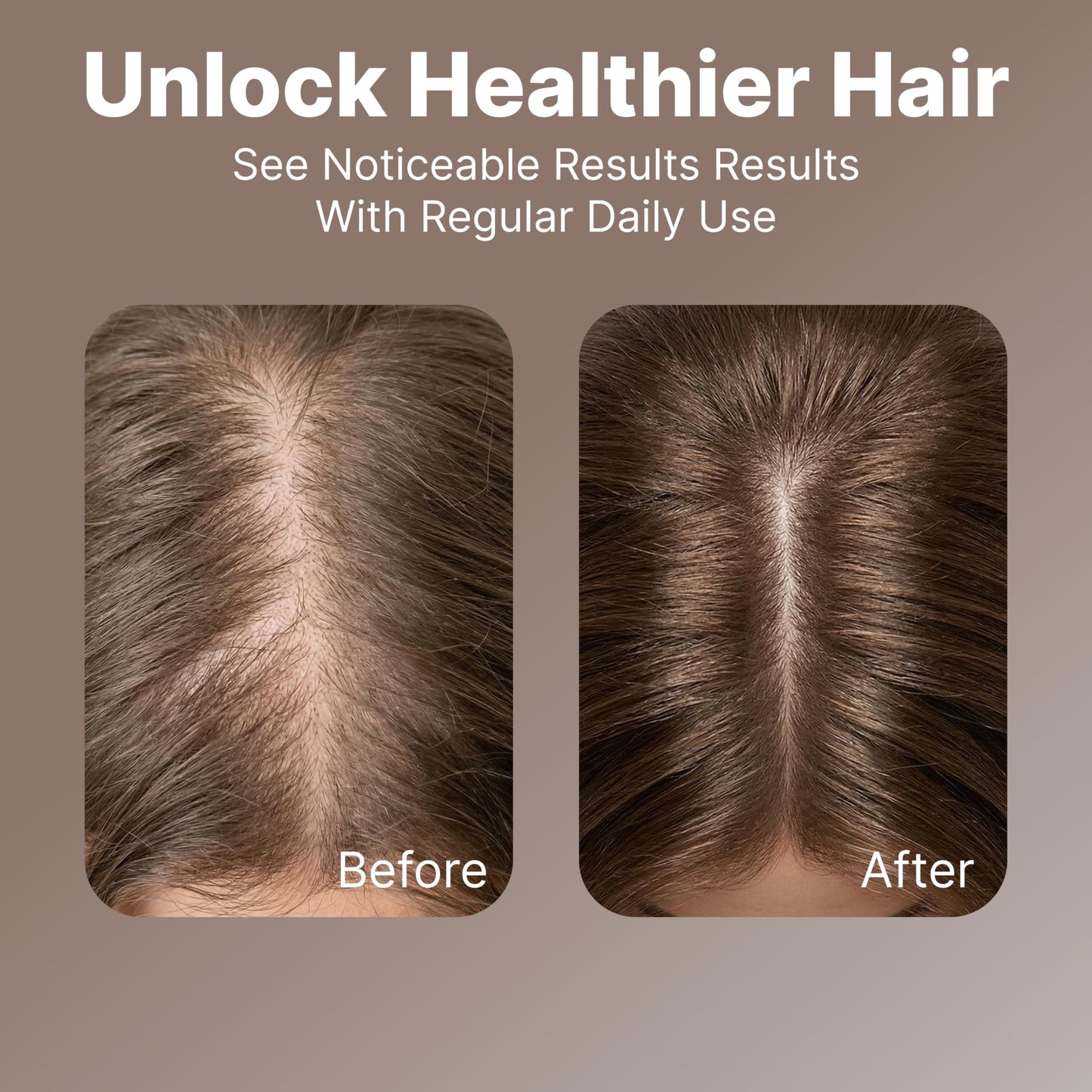 Hair Growth Serum for Women - Scalp Treatment for Hair Loss & Thinning Hair - Caffeine Peptide Regrowth Serum - Hair Thickening Serum - Natural Strengthening