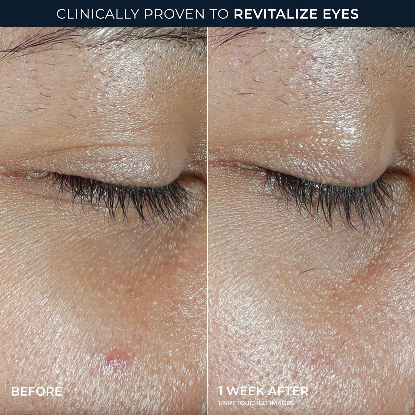 RoC Multi Correxion Revive + Glow Eye Balm with Vitamin C (0.14 oz) + Retinol Eye Cream Packette (Packaging May Vary)