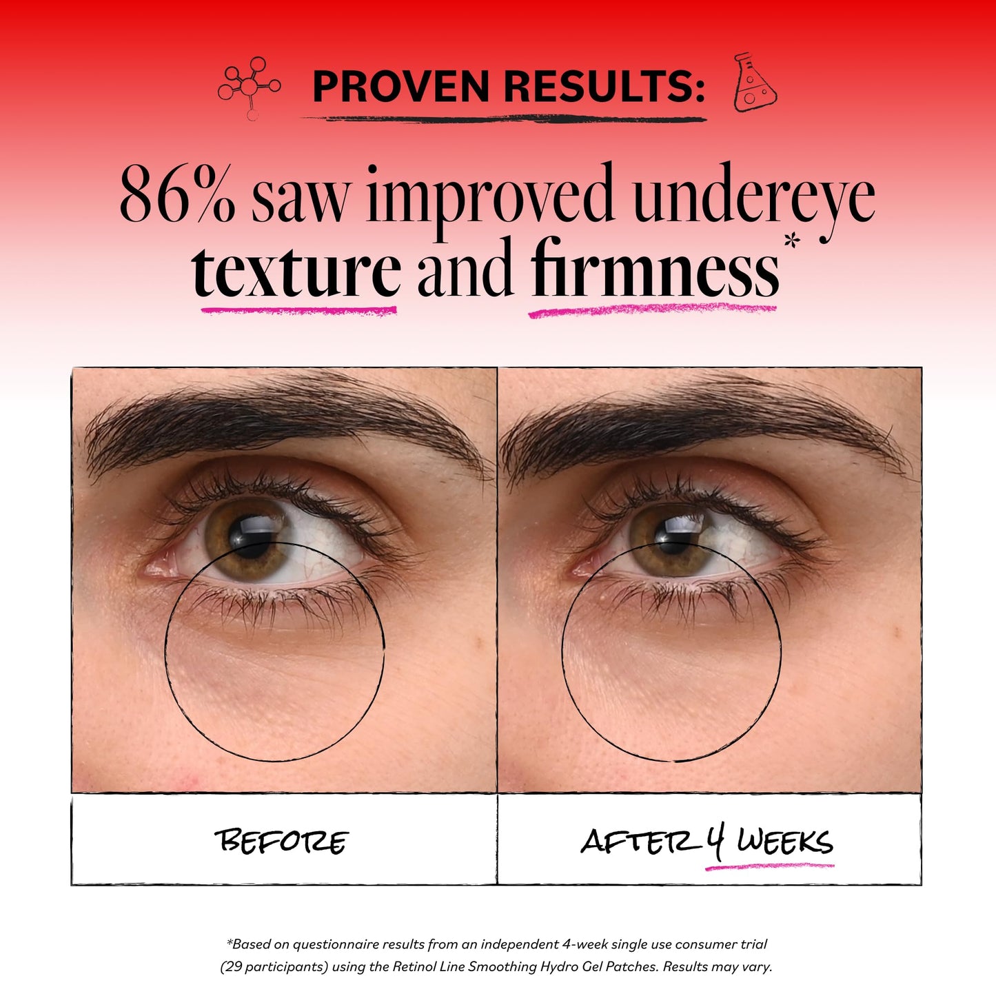 Derma E Retinol + Bakuchiol Under Eye Patches (30 Pairs) Non-Irritating, Line Smoothing Hydro Gel Eye Patches with Rose Water & Real Hibiscus Petals, Helps Reduce Fine Lines, Crow's Feet, 60ct