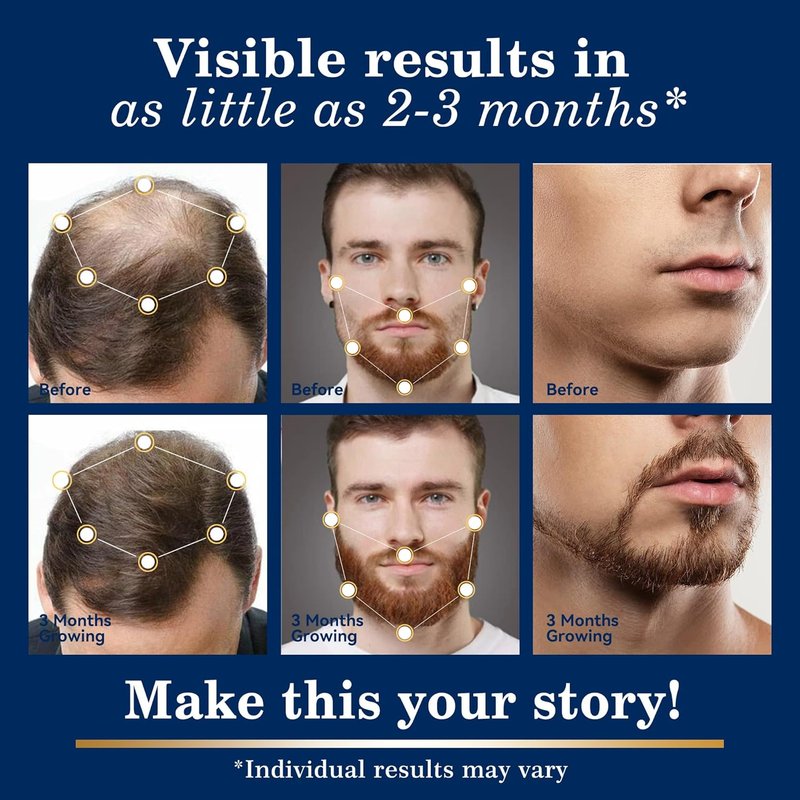 Minoxidil Hair Growth Solution - Extra Strength Beard Spray Kit with Biotin for Thicker Hair - 2PCS